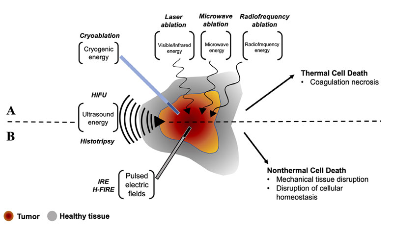 Tumor ablation in veterinary oncology