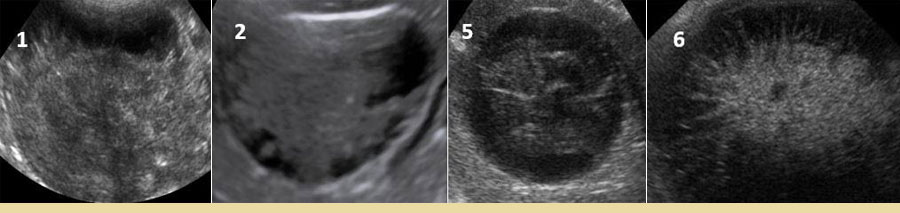 The gallbladder mucocele in dogs