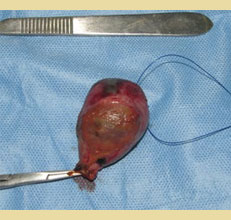 The gallbladder mucocele in dogs