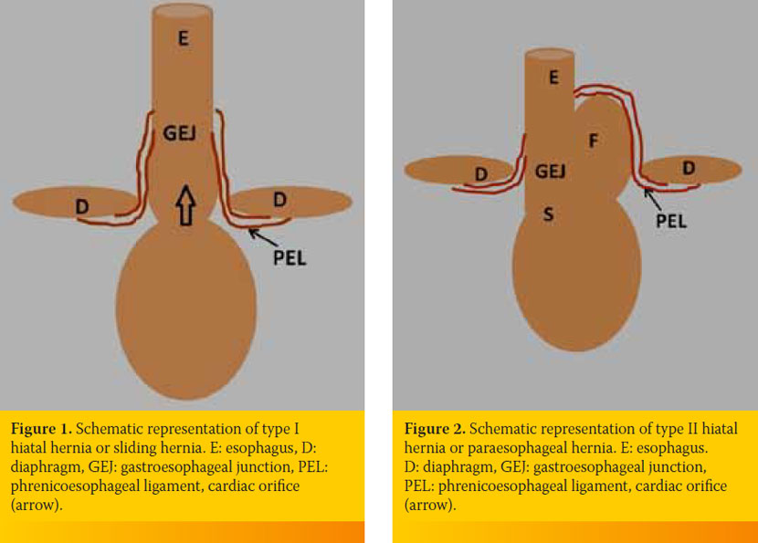 Current views regarding hiatal hernia in dogs and cats