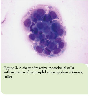 Pleural effusion in the cat: a focus on laboratory diagnosis 