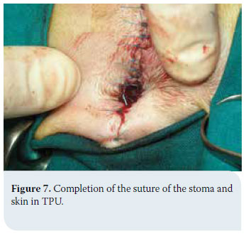 Transpelvic urethrostomy in three cats