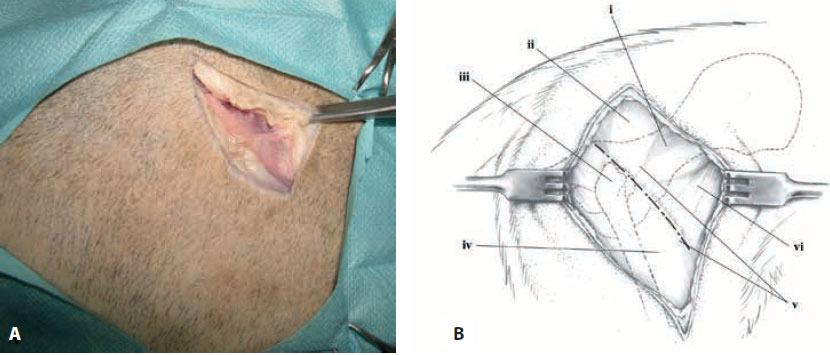v8i2 femoral head excision img3