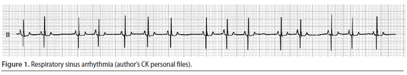 v8i2 perioperative cardiac arrhythmias img1 en