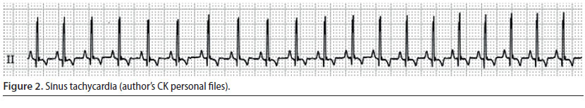 v8i2 perioperative cardiac arrhythmias img2 en
