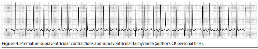 v8i2 perioperative cardiac arrhythmias img4 en