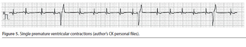 v8i2 perioperative cardiac arrhythmias img5 en